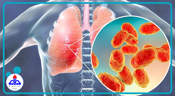 مواقب باشیم دچار پنومونی نشویم 3